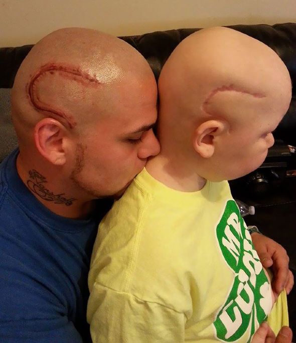 cancer tattoo scar son father josh mash marshall 5 2