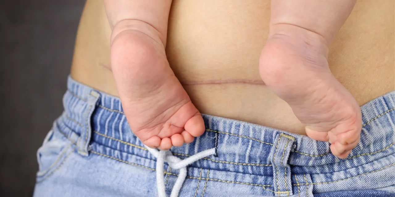 Πώς αλλάζουν μετά τον τοκετό το σώμα, το δέρμα, ακόμα και το νούμερο του παπουτσιού σου